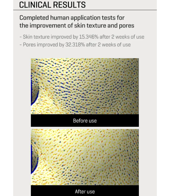 SOME BY RETINOL 4.png