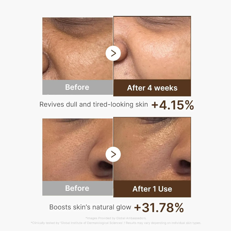 VITA C MEDICUBE 4.png